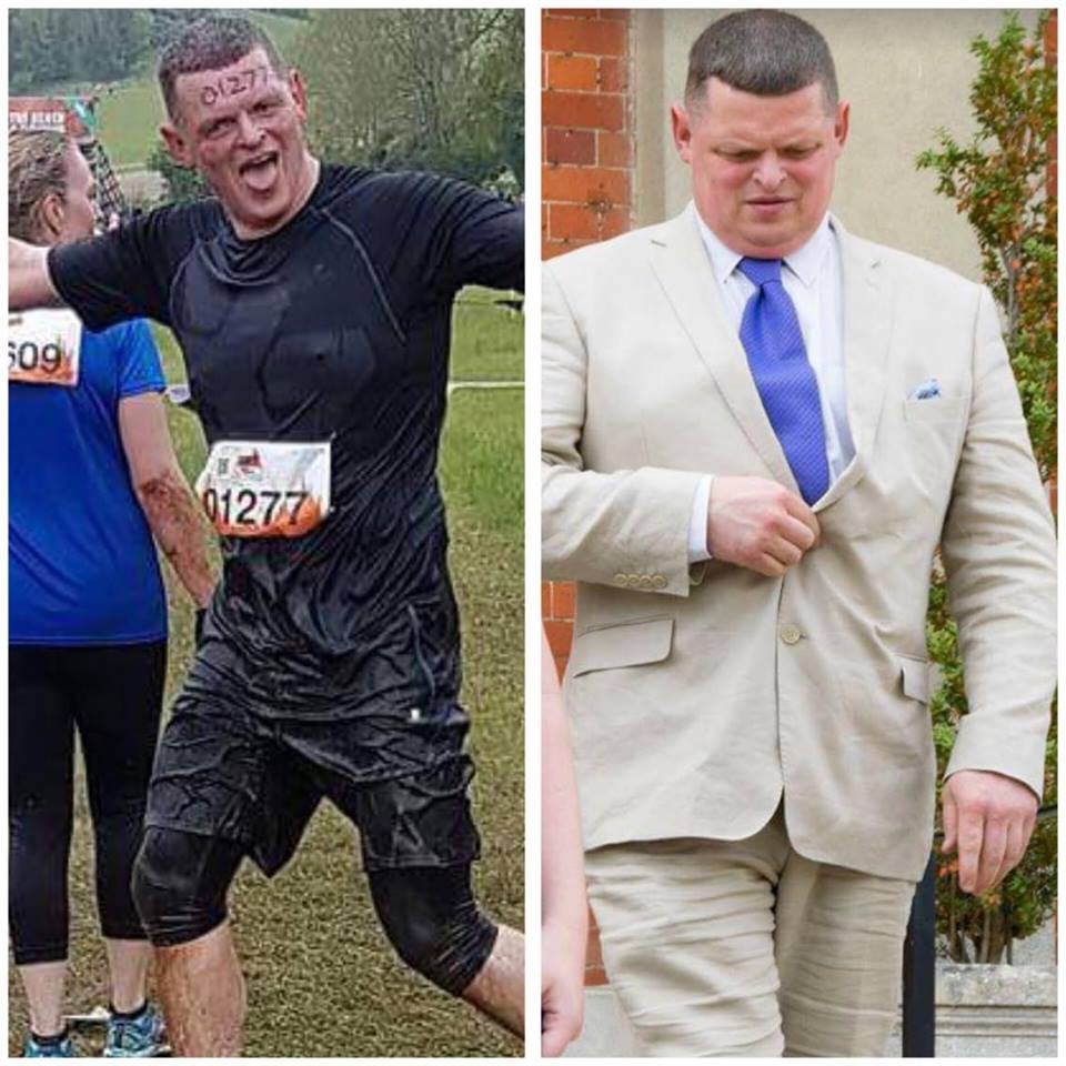 Weight Loss